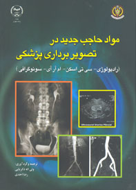 مواد حاجب جديد در تصويربرداري پزشكي در راديولوژي - سي تي اسكن - MRE)